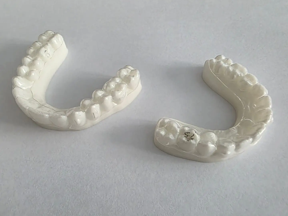 Прозрачные ортодонтические каппы элайнеры с лазерной маркировкой шага на 3D печатных моделях челюстей